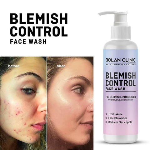 Blemish Control Face Wash - Bolan Clinic